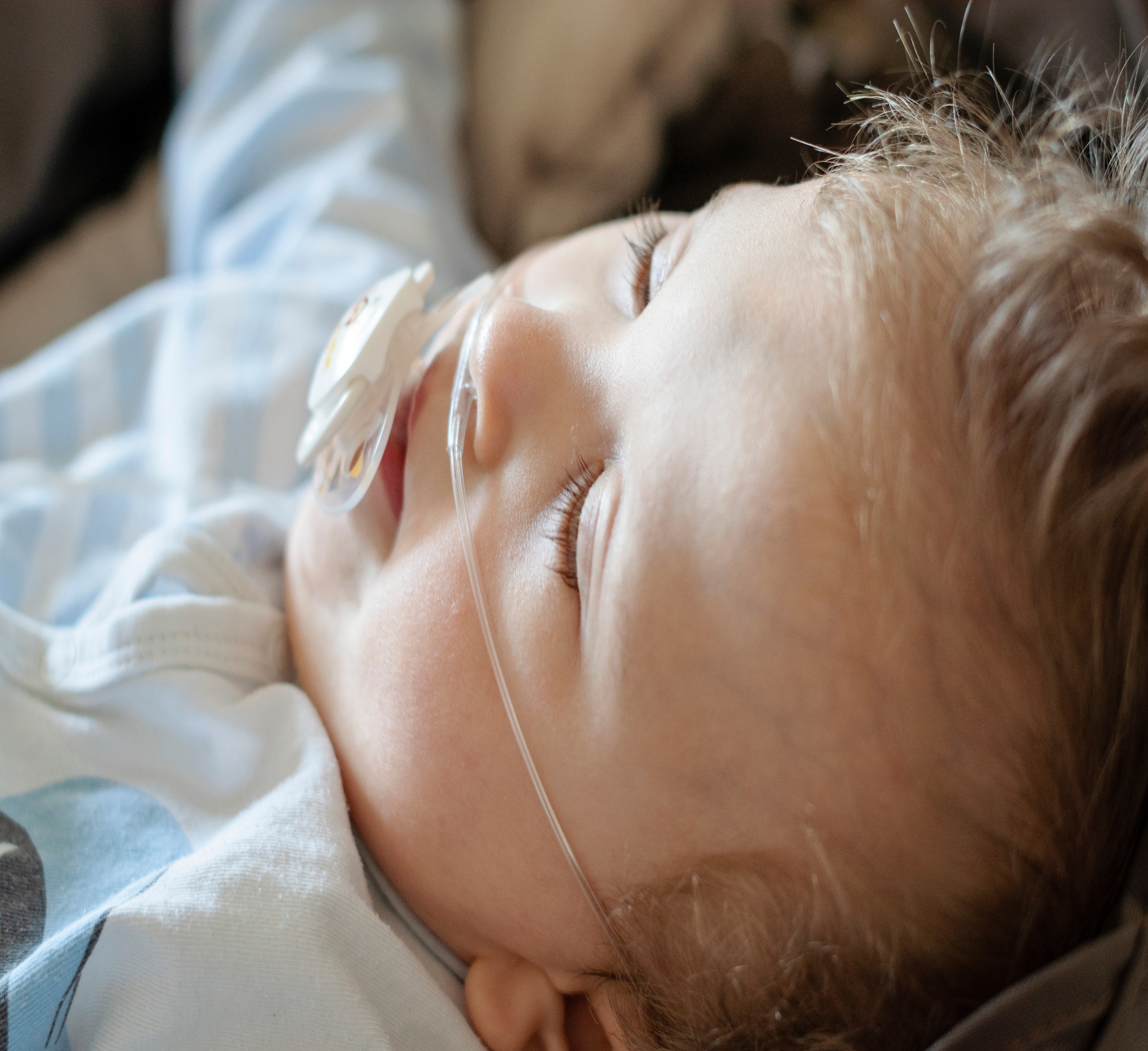 Little boy with breathing tube sleeping